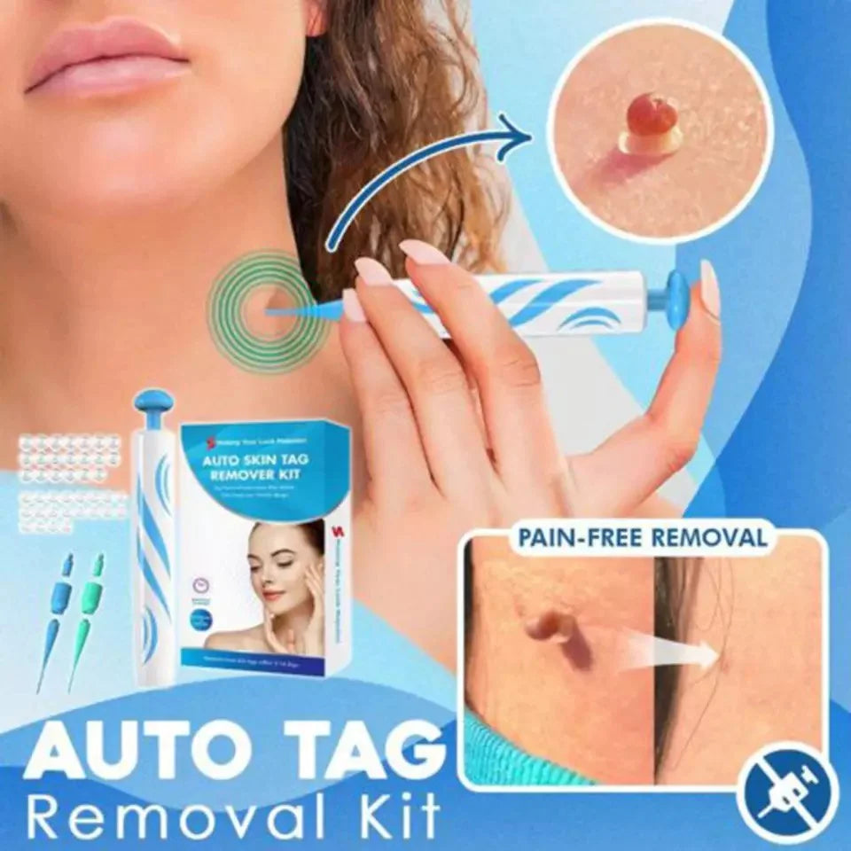 Aero Tag Remover Kit For Gentle Everyday Skin Care - Ormexis