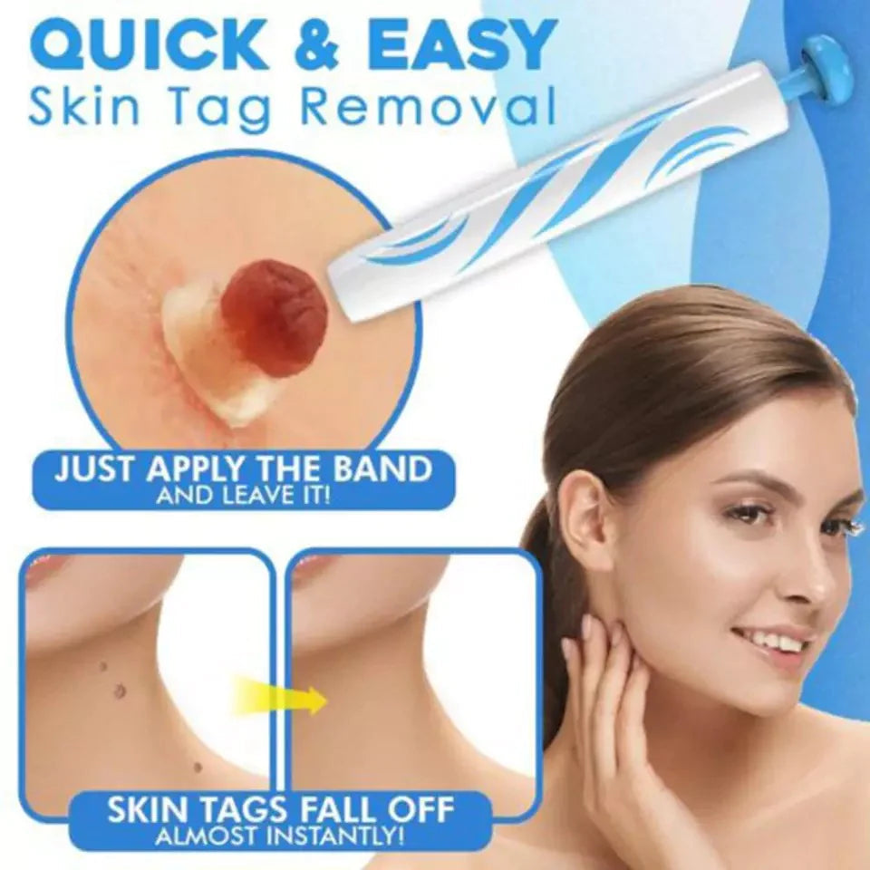 Aero Tag Remover Kit For Gentle Everyday Skin Care - Ormexis