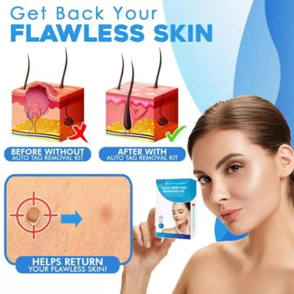 Aero Tag Remover Kit For Gentle Everyday Skin Care - Ormexis