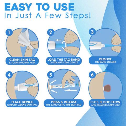 Aero Tag Remover Kit For Gentle Everyday Skin Care - Ormexis