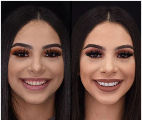 NovaBright Snap-On Veneers For Top And Bottom Teeth Custom Fit Removable Smile Solution